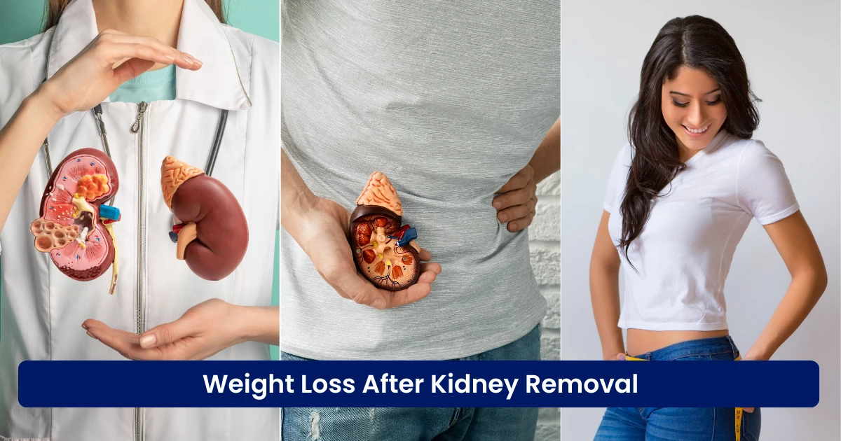 Weight Loss After Kidney Removal