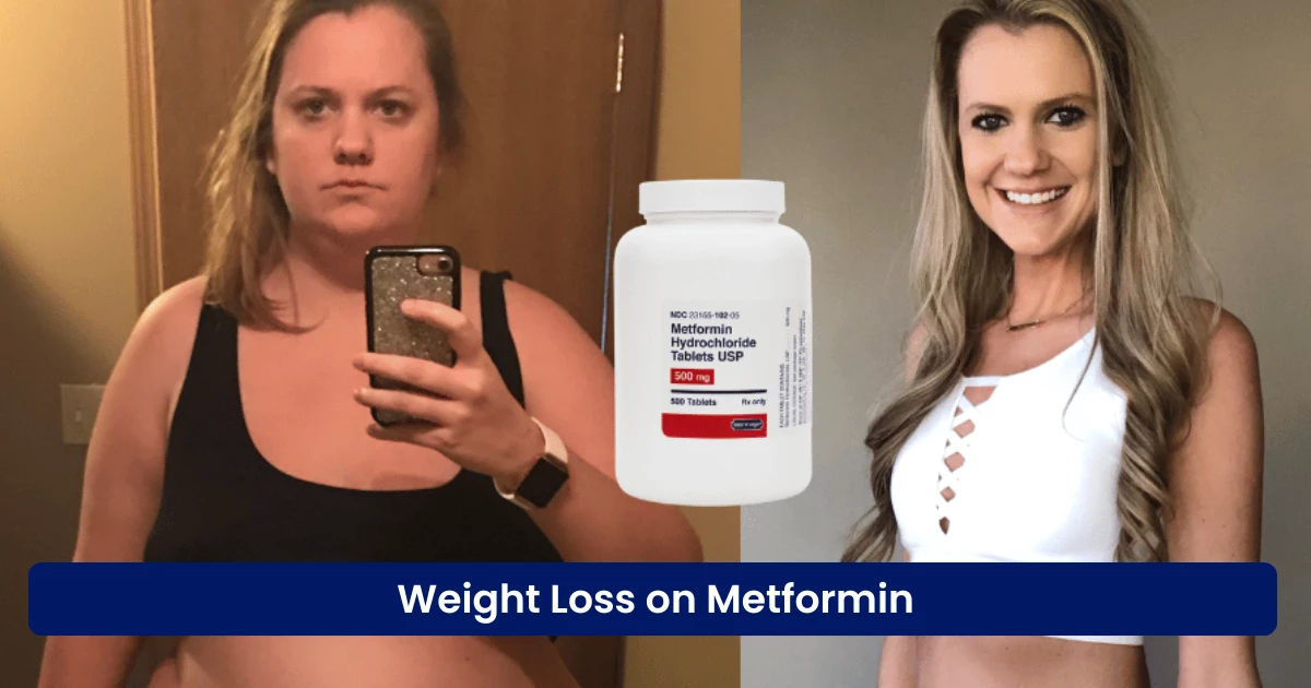 Weight Loss on Metformin