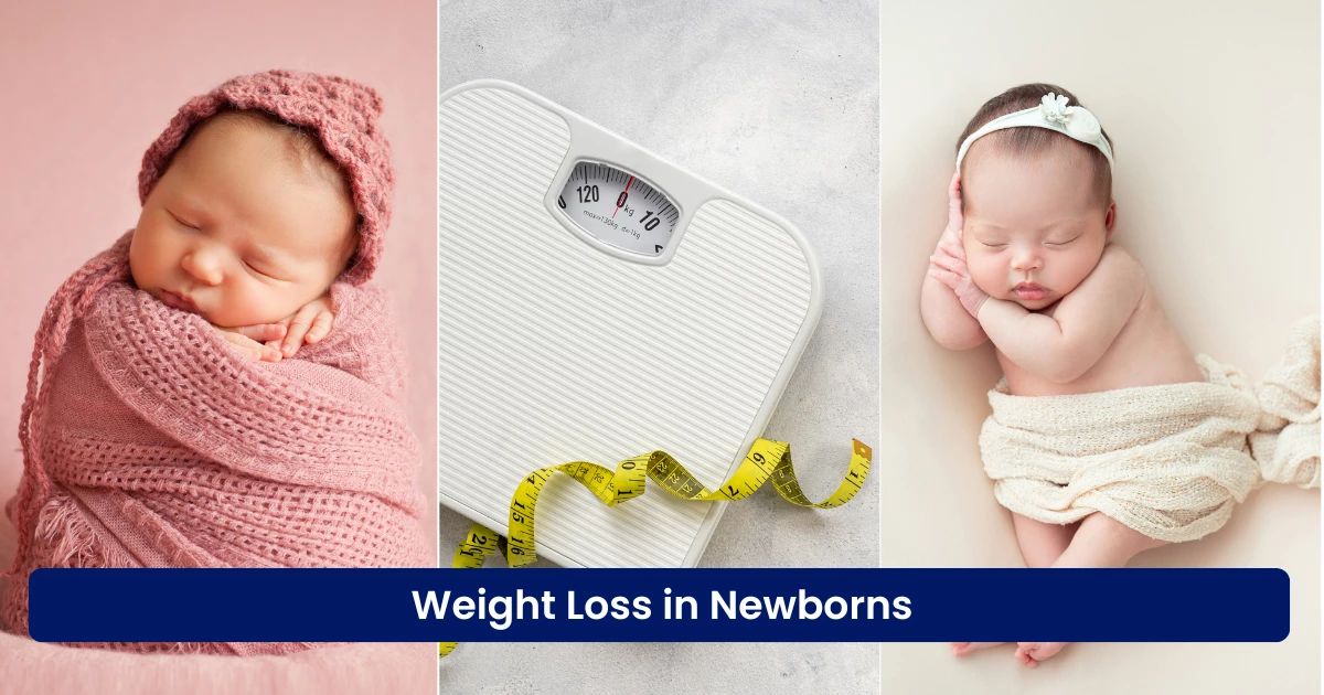 Weight Loss in Newborns